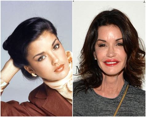 Sneaky plastic surgeries used by celebs to look better than you